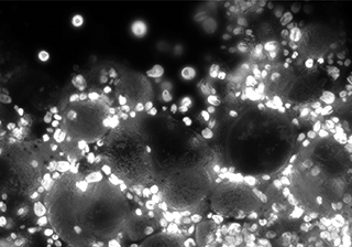 高靈敏度近紅外