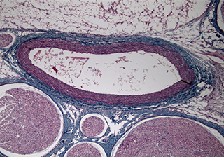 神經(jīng)元細胞